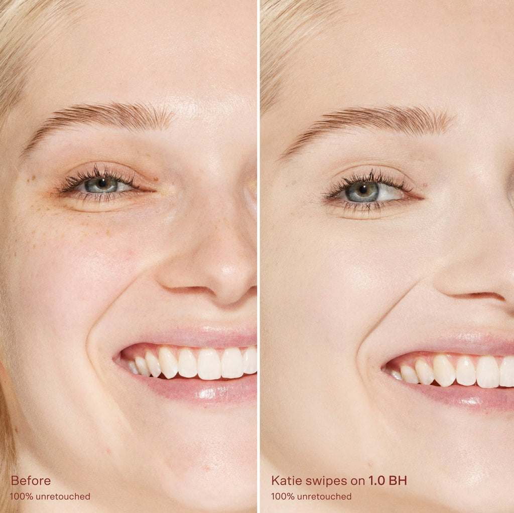 Before-and-after-comparison-of-a-woman-s