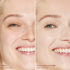 Before-and-after-comparison-of-a-woman-s