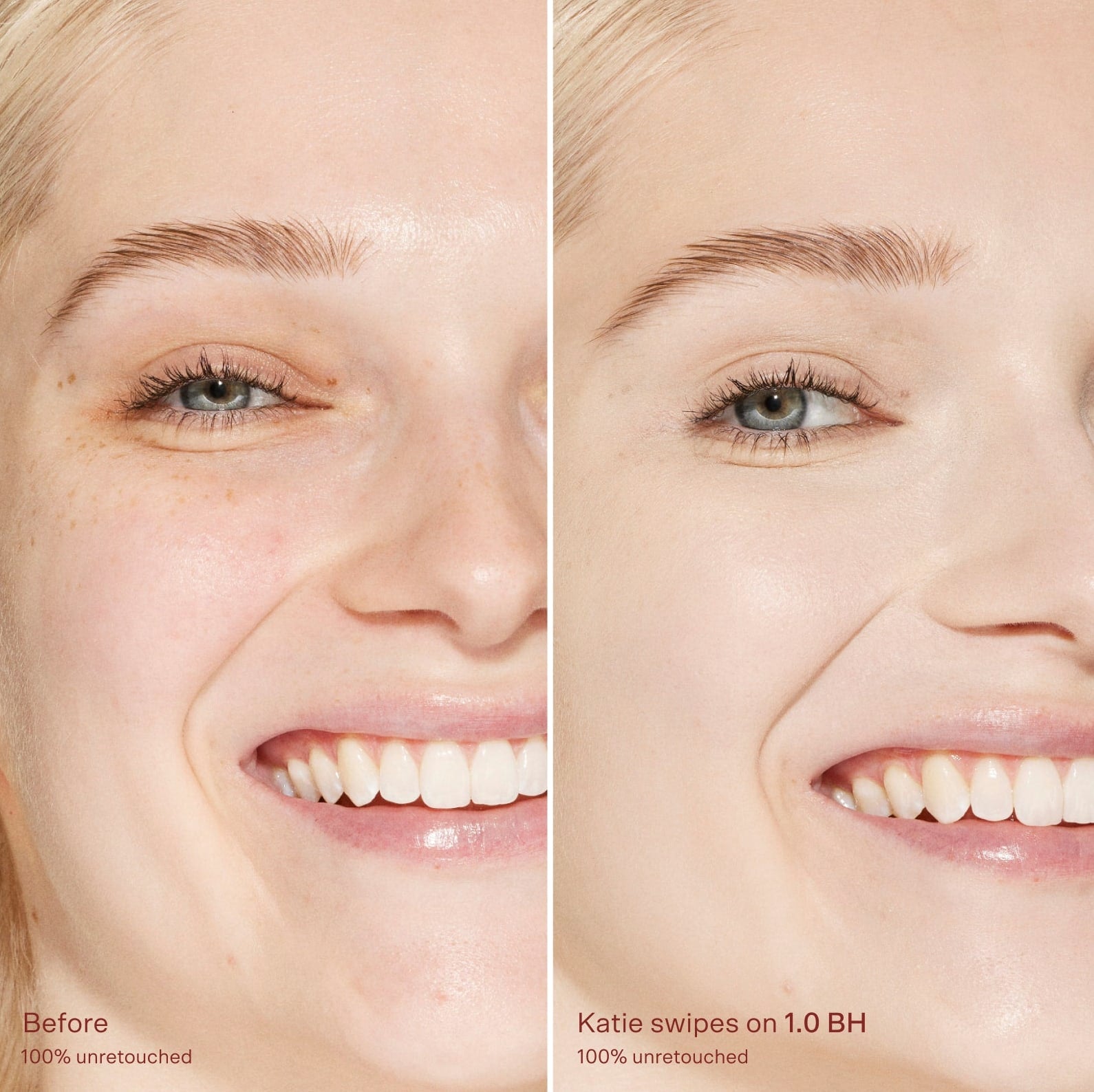 Before-and-after-comparison-of-a-woman-s