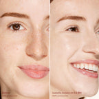 Before-and-after-comparison-of-a-woman-s