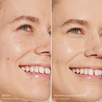 Before-and-after-comparison-of-a-woman-s