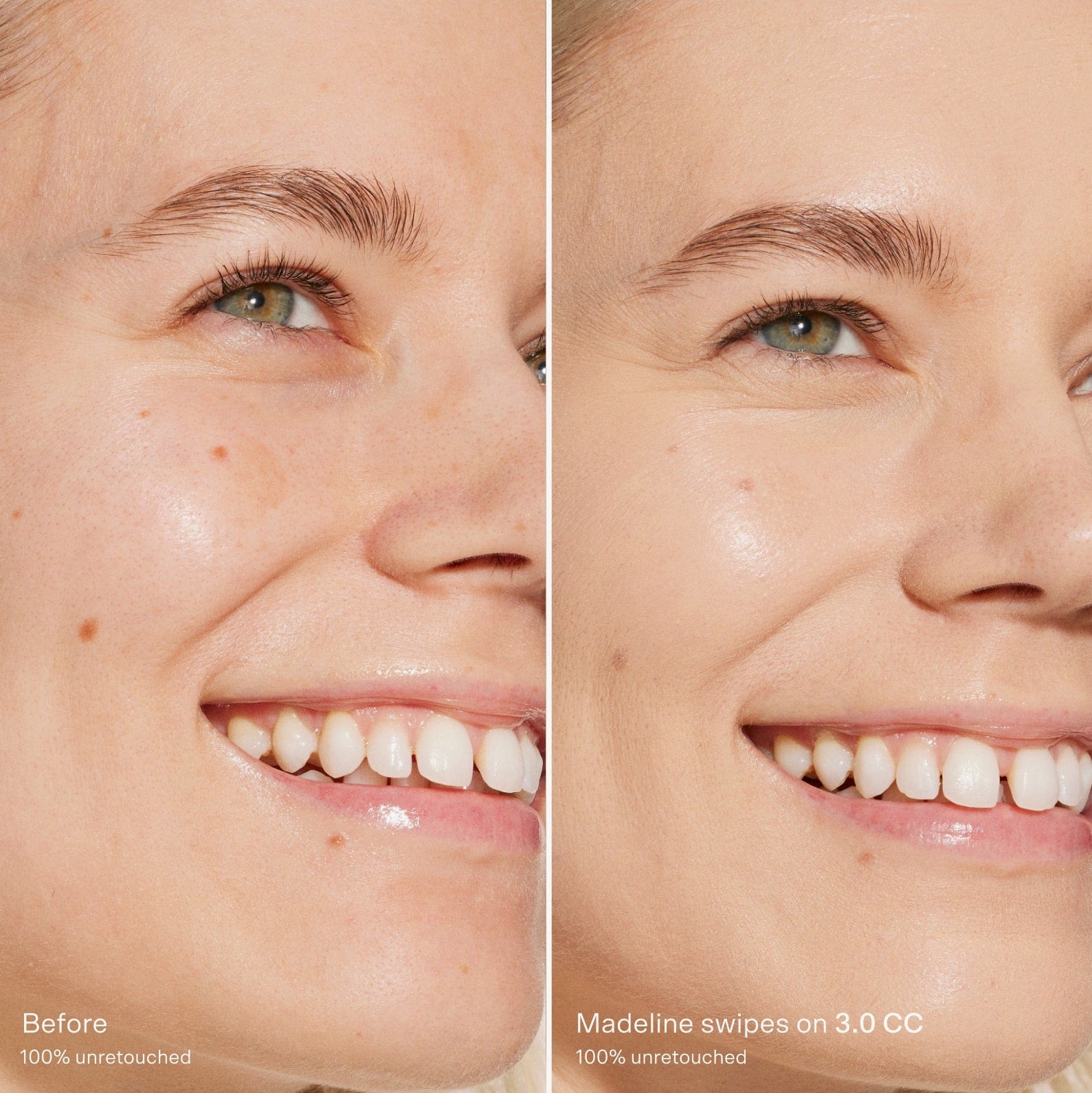 Before-and-after-comparison-of-a-woman-s
