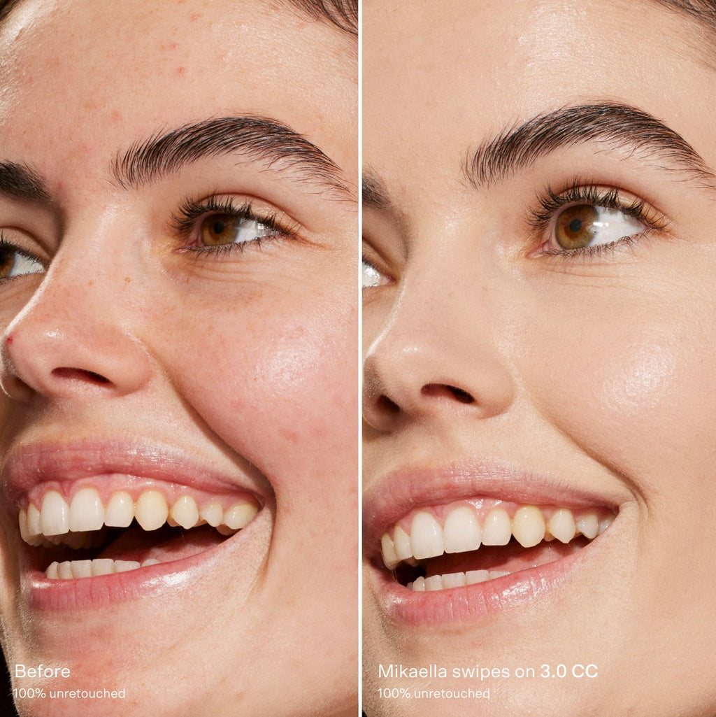 Before-and-after-comparison-of-a-woman-s