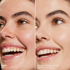 Before-and-after-comparison-of-a-woman-s