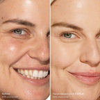 Before-and-after-comparison-of-a-woman-s