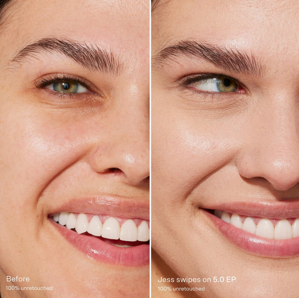 Before-and-after-comparison-of-a-woman-s