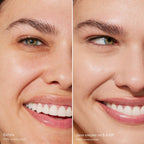 Before-and-after-comparison-of-a-woman-s