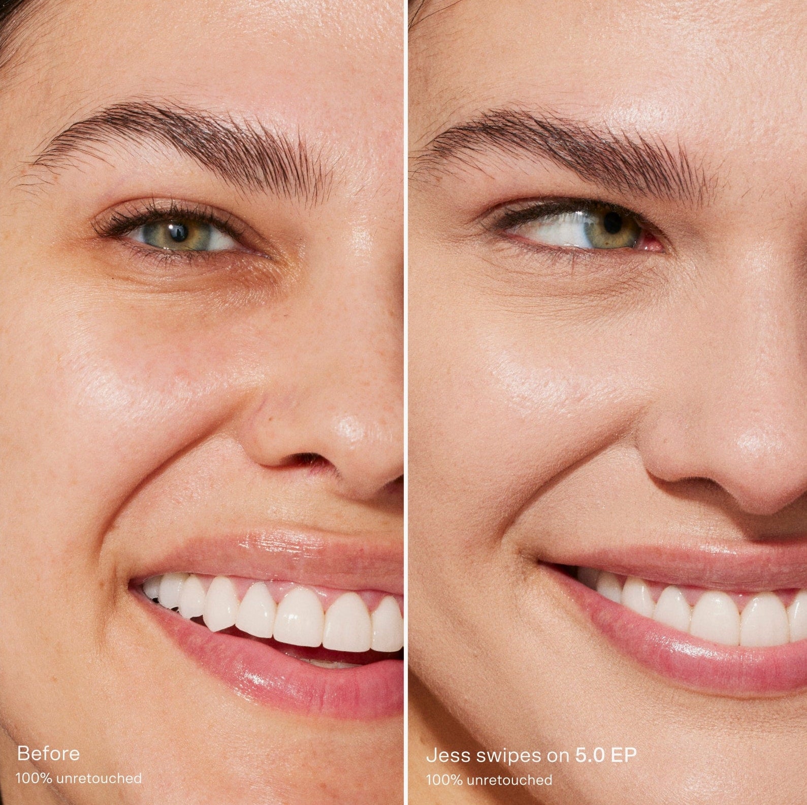 Before-and-after-comparison-of-a-woman-s